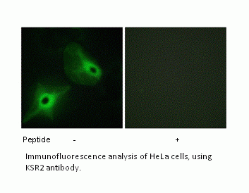 Anti-KSR2