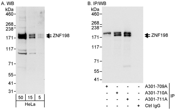 Anti-ZNF198
