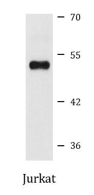 Anti-ADRA1B