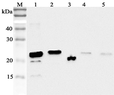 Anti-RBP4 (human)