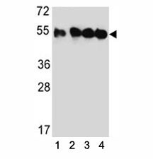 Anti-TUBB2C (Tubulin beta 2C)
