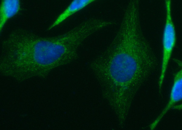 Anti-Isovaleryl-CoA dehydrogenase/IVD Monoclonal Antibody