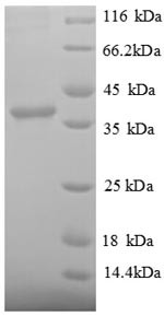 Signal recognition particle 14KDA protein (SRP14), partial, human, recombinant