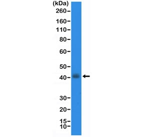 Anti-Thyroid transcription factor 1 / TTF-1 / NKX2.1, clone RM373