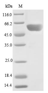 Serine/threonine-protein phosphatase 2A 55 kDa regulatory subunit B gamma isoform (PPP2R2C), human,