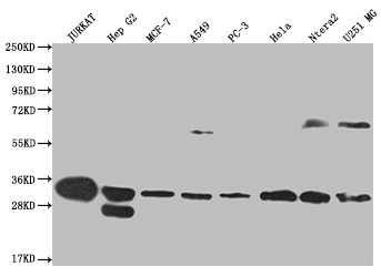 Anti-PSME1 Recombinant Monoclonal, clone 29D5