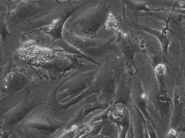 HROG33 T0 M1 Cells