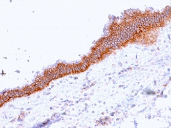 Anti-ABCC3 / MRP3, clone ABCC3/2971