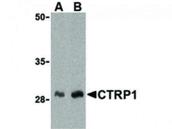 Anti-CTRP1