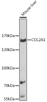 Anti-COL2A1