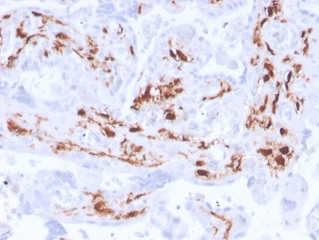 Anti-Factor XIIIa / F13A1, clone F13A1/3772R
