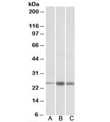 Anti-TNNI2
