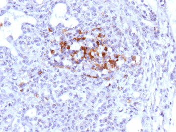 Anti-C9 / Complement component 9, clone r10A6