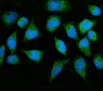 Anti-MTMR2 / Myotubularin-related protein 2
