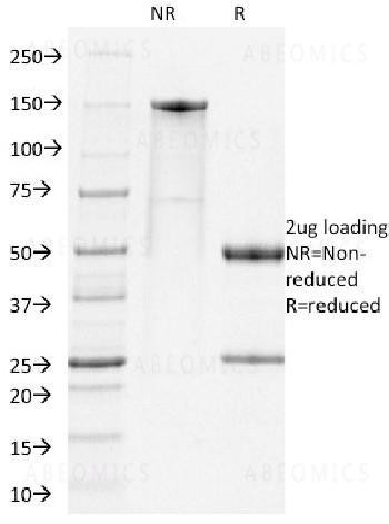 Anti-PD1, Mouse Monoclonal Antibody (Clone: RMP1-14)