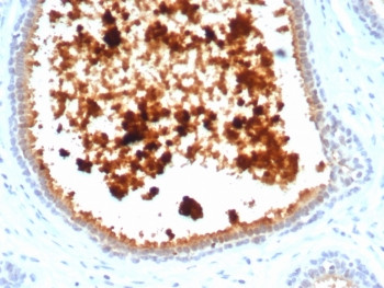 Anti-Mammaglobin A / SCGB2A2, clone MGB/4811R