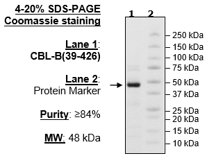 CBL-B, His-tag, Biotin-labeled