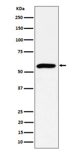 Anti-PRPF4 / Pre mRNA processing factor 4, clone 30P52