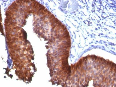 Anti-Cytokeratin 17(E3), CF568 conjugate, 0.1mg/mL
