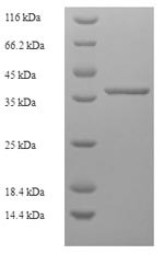 MLX-interacting protein (MLXIP), human, recombinant