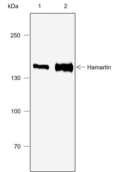 Anti-Recombinant Hamartin, clone A773