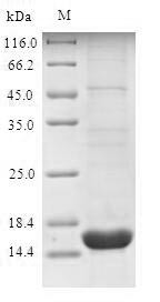 Sodium-dependent phosphate transport protein 2B (SLC34A2), partial, human, recombinant