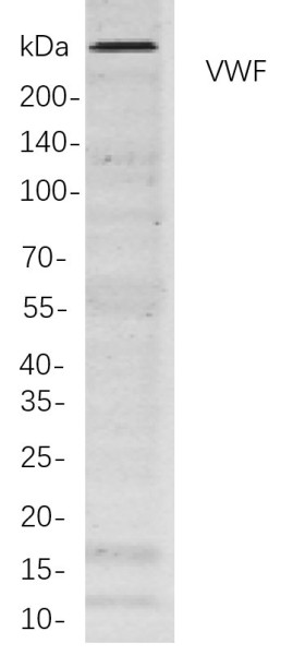 Anti-Recombinant VWF, clone 9B6