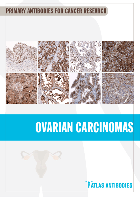 Atlas Antibodies Ovarian Cancer Markers