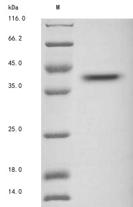 Protein Wnt-2 (WNT2), human, recombinant
