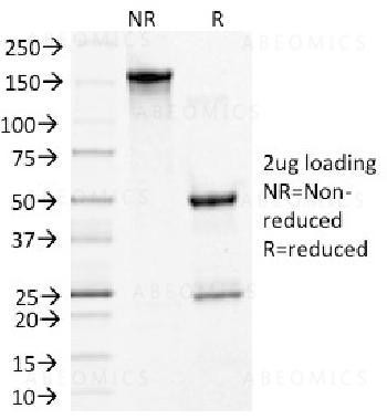 Anti-Desmoglein-3 (Squamous Cell Marker) Monoclonal Antibody (Clone: 5G11)