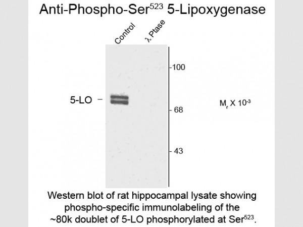 Anti-phospho-5-Lipoxygenase (Ser523)