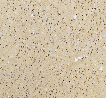 Anti-Intersectin 1 / ITSN1
