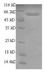 RNA-binding motif protein, Y chromosome, family 1 member A1 (RBMY1A1),partial, human, recombinant