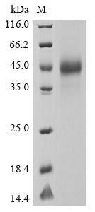 Spike glycoprotein (S), partial, human coronavirus OC43, recombinant