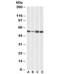 Anti-ATP5A1