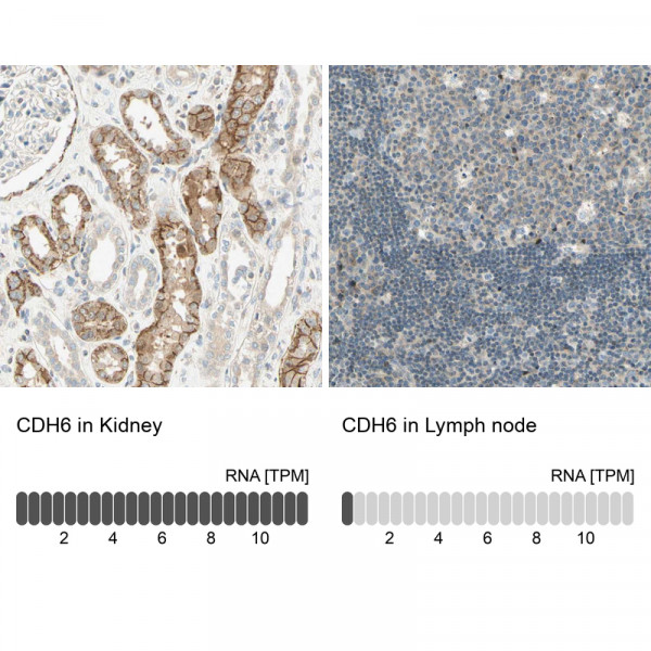 Anti-CDH6