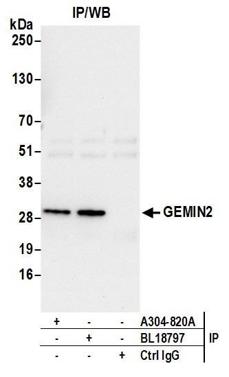 Anti-GEMIN2