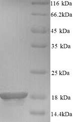Baculoviral IAP repeat-containing protein 5 (Birc5), mouse, recombinant