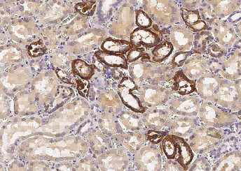 Anti-VE-Cadherin/CD144 Monoclonal Recombinant Antibody