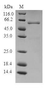 Proteasome activator complex subunit 1 (PSME1), human, recombinant