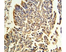 Anti-HSP27