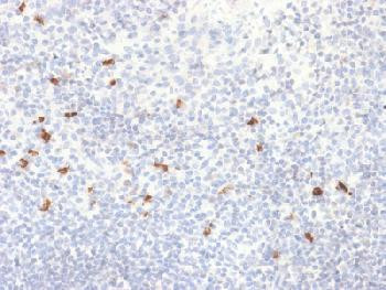 Anti-IgG4 (Ig Heavy Constant Gamma 4) (G4m Marker) Recombinant Rabbit Monoclonal Antibody (clone:IGH