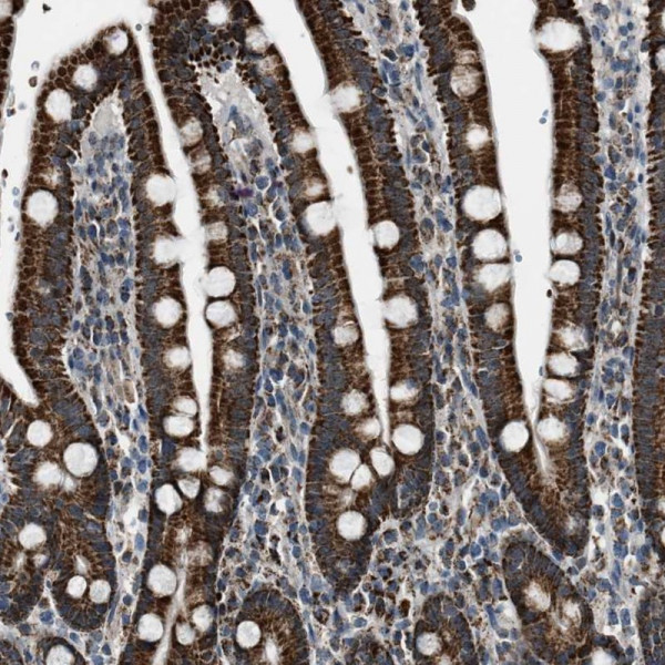 Anti-CHN2