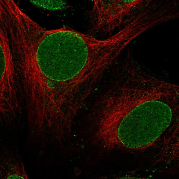 Anti-ZNF20