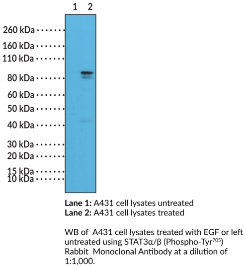 Anti-STAT3alpha/beta (Phospho-Tyr705) Rabbit Monoclonal Antibody (Clone RM261)
