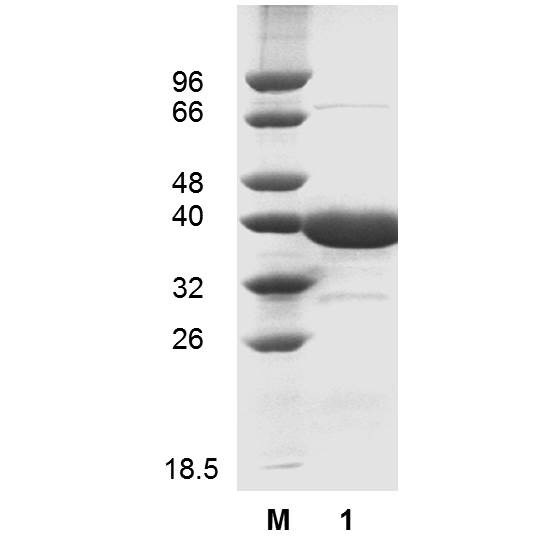Arginase (EC 3.5.3.1), Homo sapiens liver