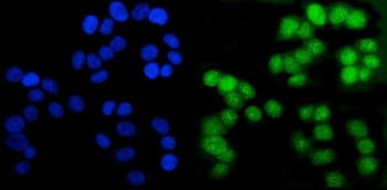Anti-Androgen Receptor