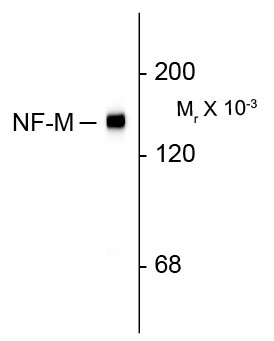 Anti-Neurofilament NF-M, clone 3H11