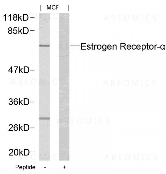 Anti-Estrogen Receptor- Alpha (Ab-167)