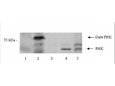 Anti-PNK (Polynucleotide Kinase)